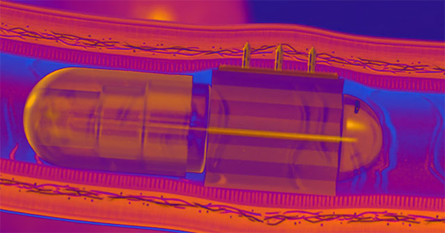 Unique injection technology does not hurt by stabbing needles straight into the intestinal wall