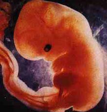 Unusual fetal findings from 7 weeks of age