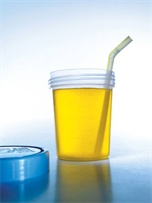Urine is medicine?