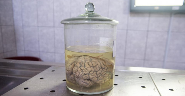 US military invests $ 65 million to study brain implants