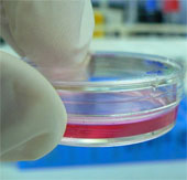 Use amniotic sac tissue to protect and cultivate damaged cornea