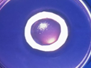 Use artificial cornea to restore vision