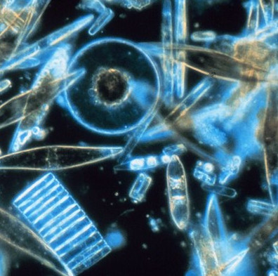 Use genetically algae to treat cancer