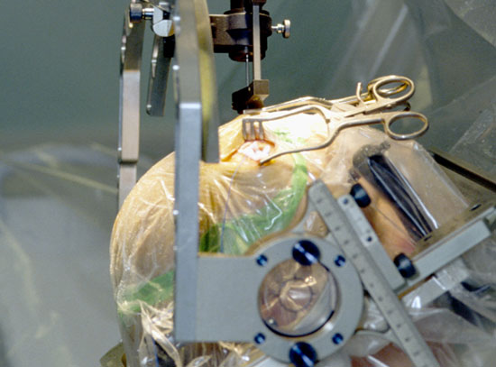 Use microelectrodes to bring drugs into the brain