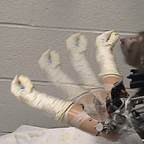 Use the brain to manipulate the prosthesis