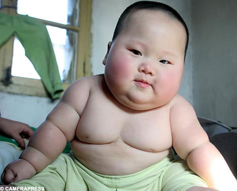 Using anti-obesity instead of weight control surgery?