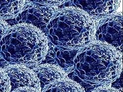 Using nanotechnology and cancer light treatment