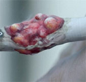 Video: A close-up of the gruesome destruction of smoking