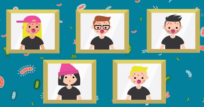 Video: Bacteria make humans grow more acne