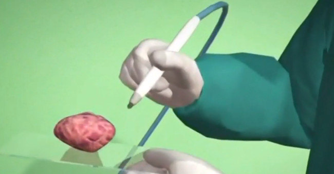 Video: Pen diagnoses cancer for 10 seconds