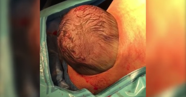 Video: The baby comes out of the womb