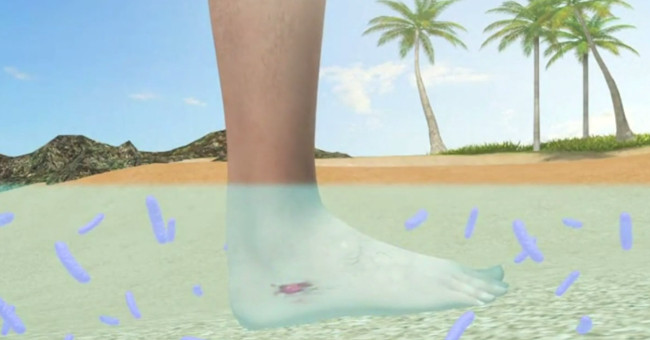 Video: Two lines penetrate the body of the human cannibalistic bacteria
