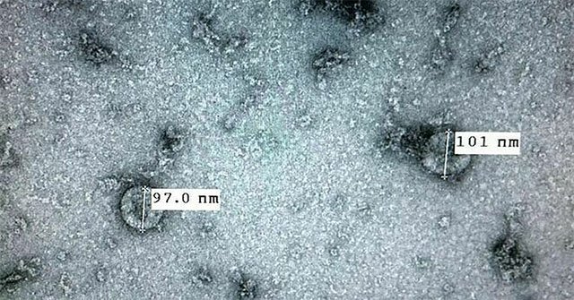 Vietnam has successfully cultivated nCoV virus