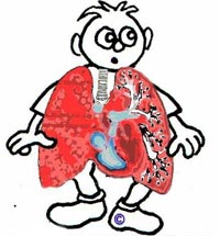 Vietnam has the highest rate of chronic lung disease in the region