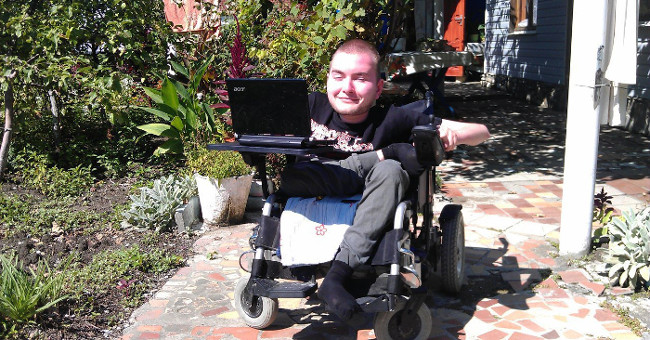 Vietnam is ready to recruit donors - recipients for transplanting heads