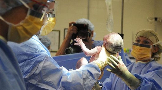 Virtual birth software helps diagnose unborn babies