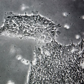 Virus detection makes people silly