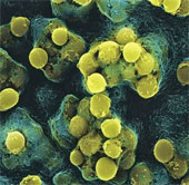 Virus infected 10 people, dead 9 easy to spread on air?