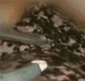 Visual video of smokers' black lungs