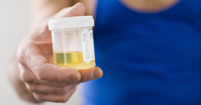 Warning about health status from urine