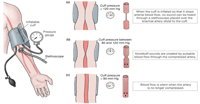 Warning about the type of application for fingerprint blood pressure measurement is very dangerous