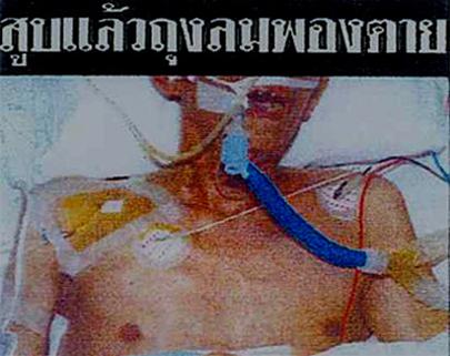 Warning effect on cigarette packaging