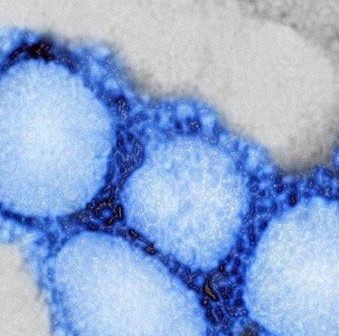 Warning of the risk of outbreaks from new SARS-like viruses