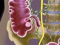 Watch for gastrointestinal bleeding