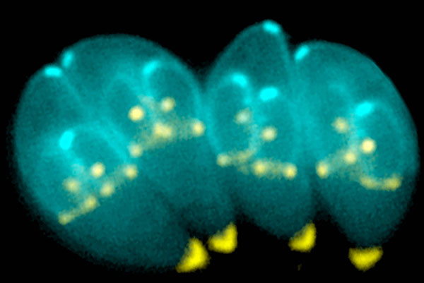 Watch out for deadly parasite infections from cats