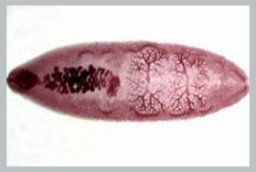 Watch out for intestinal fluke