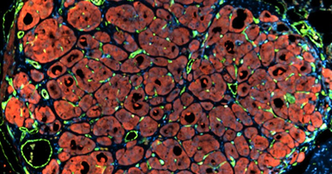 We have come closer to saving people by liver from the laboratory