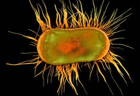 What do you understand about infections?