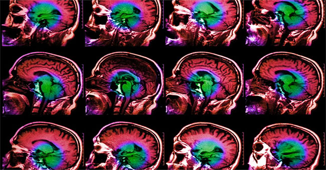 What does sadness look like in the brain?