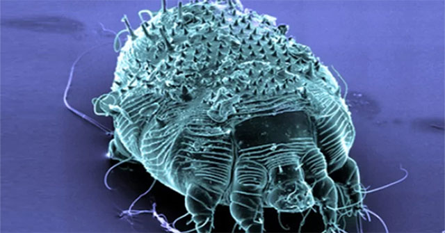 What is scabies?