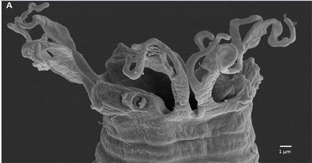What is the role of nematode in the Vietnamese female doctor who spent a decade decoding?
