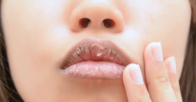What lips reveal something about your health?