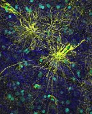 What makes humans different from the rats?