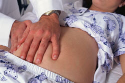 What should women with lupus do during pregnancy?
