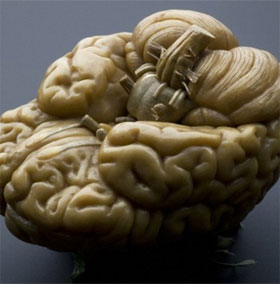 What will happen if the electric click on the brain dies?