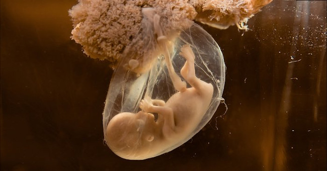 What's the difference between a test-tube baby?