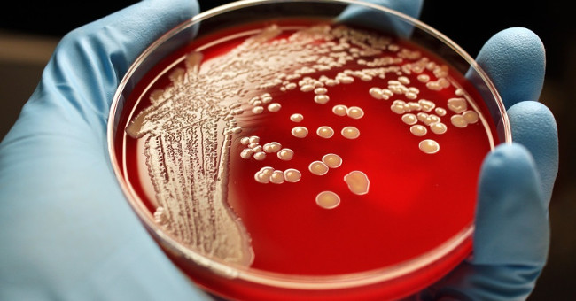 When antibiotics become useless, more people die from bacteria than cancer