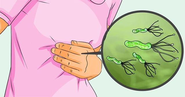 When do HP bacteria cause stomach cancer?