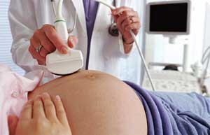 When pregnant women have heart disease