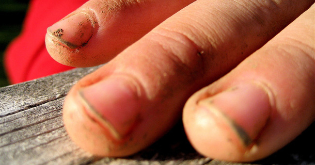 Where does the stain of color written under the nail come from?