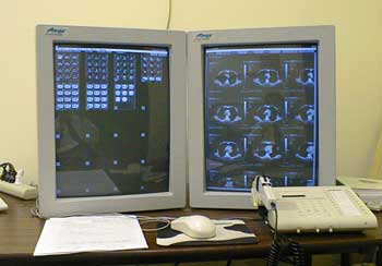 Who invented the layered computer tomography?