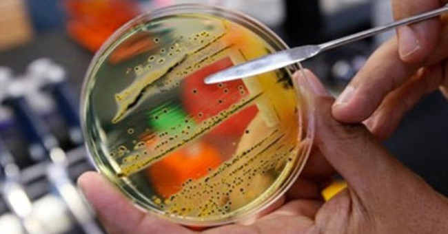 WHO published a list of 12 most worrying viruses