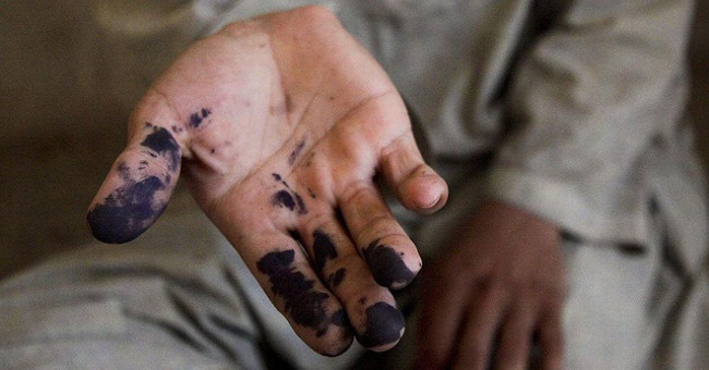 Who went to school without ever getting stuck in the hand - it's hard to clean every time, why?
