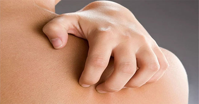 Why after a shower in the winter or itching?