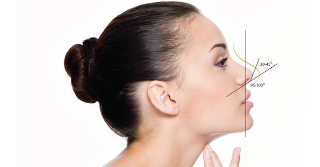 Why can a nose lift or chin fill filler cause complications?