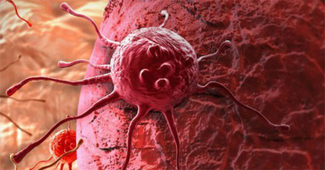 Why do cancer cells spread abnormally?